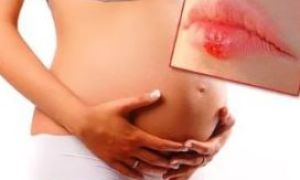 Герпес у грудного ребенка: симптомы и лечение