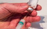 Прививка от дифтерии: график, противопоказания и побочные эффекты, что нельзя делать после