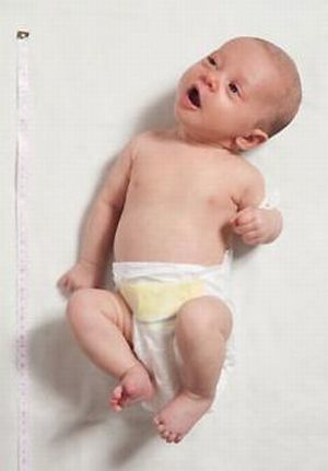 ДЦП у новорожденных: симптомы и признаки, как проявляется и распознается