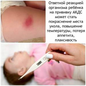 Прививка от столбняка: побочные действия и эффекты, болит место укола