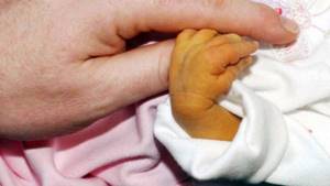 Желтуха у новорожденных: причины и последствия, когда должна пройти