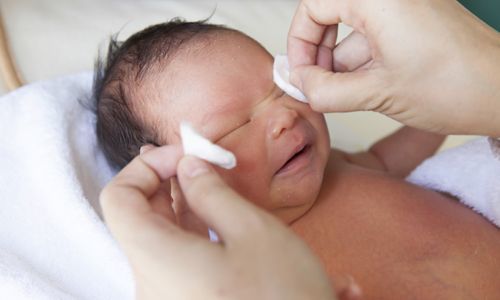 Дакриоцистит у новорожденных: симптомы и лечение, что делать