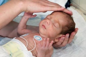 Синдром угнетения у новорожденных: причины, диагностика и лечение, последствия