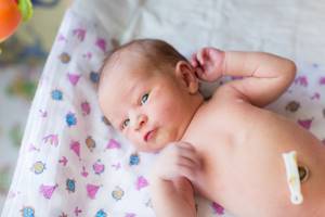 Гноится пупок у новорожденного: причины и что делать?