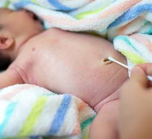 Когда отпадает прищепка с пупка у новорожденного: на какой день и что делать дальше