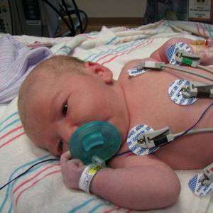 Порок сердца у новорожденных: причины, симптомы и лечение