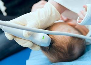 Псевдокиста в голове у новорожденного: причины и лечение