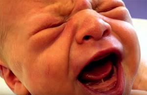 Короткая уздечка у новорожденного: как определить, причины, как подрезают