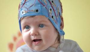 Псевдокиста в голове у новорожденного: причины и лечение
