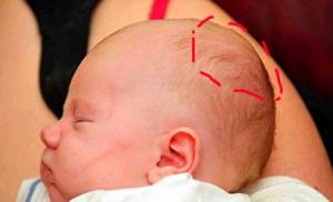 Признаки сотрясения мозга у грудного ребенка