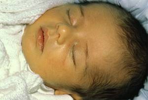 Хофитол для новорожденных: инструкция по применению, как давать, дозировка