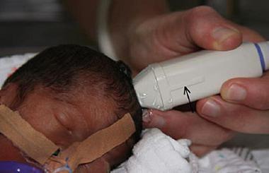 Нейросонография новорожденных: когда назначают, что показывает, расшифровка и нормы
