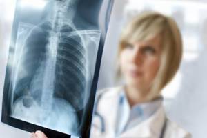 Рентген при грудном вскармливании и грудничкам: можно ли делать, последствия