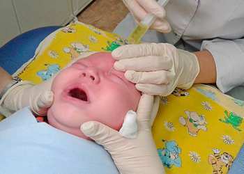 Зондирование слезного канала у новорожденных: как проводится, показания и последствия