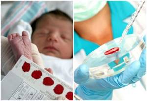 Муковисцидоз у новорожденных: симптомы и лечение, как проявляется