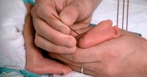 Скрининг новорожденных на наследственные заболевания: какие анализы берут