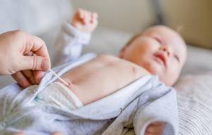 Кровит пупок у новорожденного: почему и что делать?