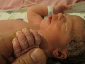 Красные веки у новорожденного: причины и диагностика, методы лечения