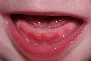 Прорезывание зубов у детей: когда начинают расти