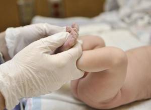 Водянка яичек у новорожденных мальчиков: причины и лечение